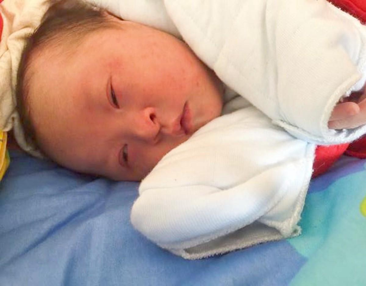 唐氏儿和正常胎儿的区别,唐氏儿和正常孩子的区别