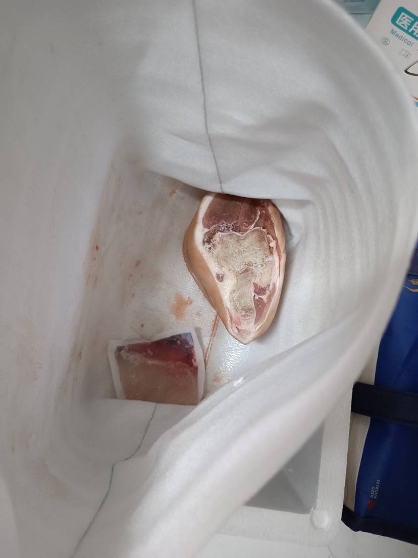 张珊珊注册了陕西多少家核酸公司,张珊珊在全国注册35家核酸公司