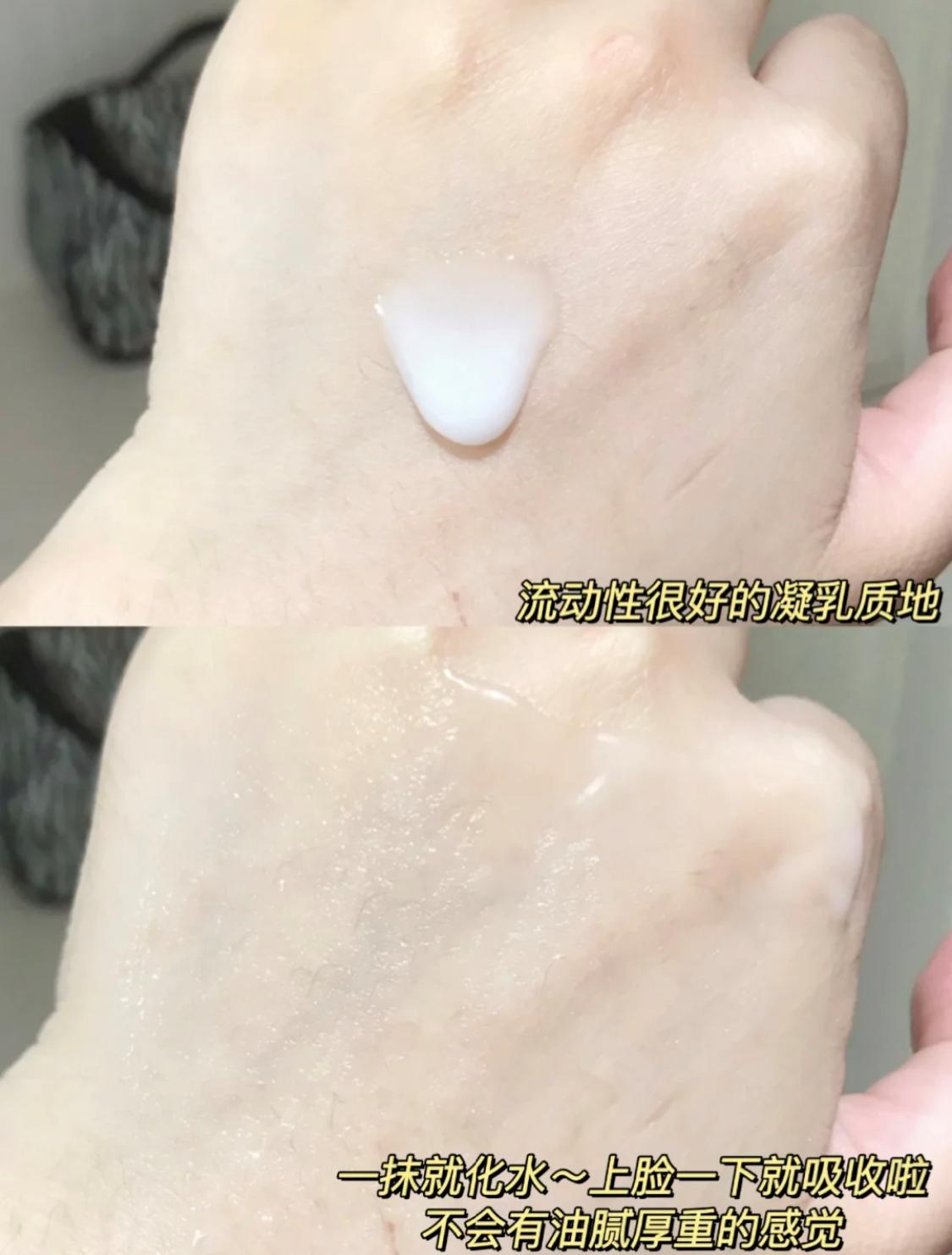 敷面膜补水了脸还是起干皮,敷面膜先补水还是敷完后补水