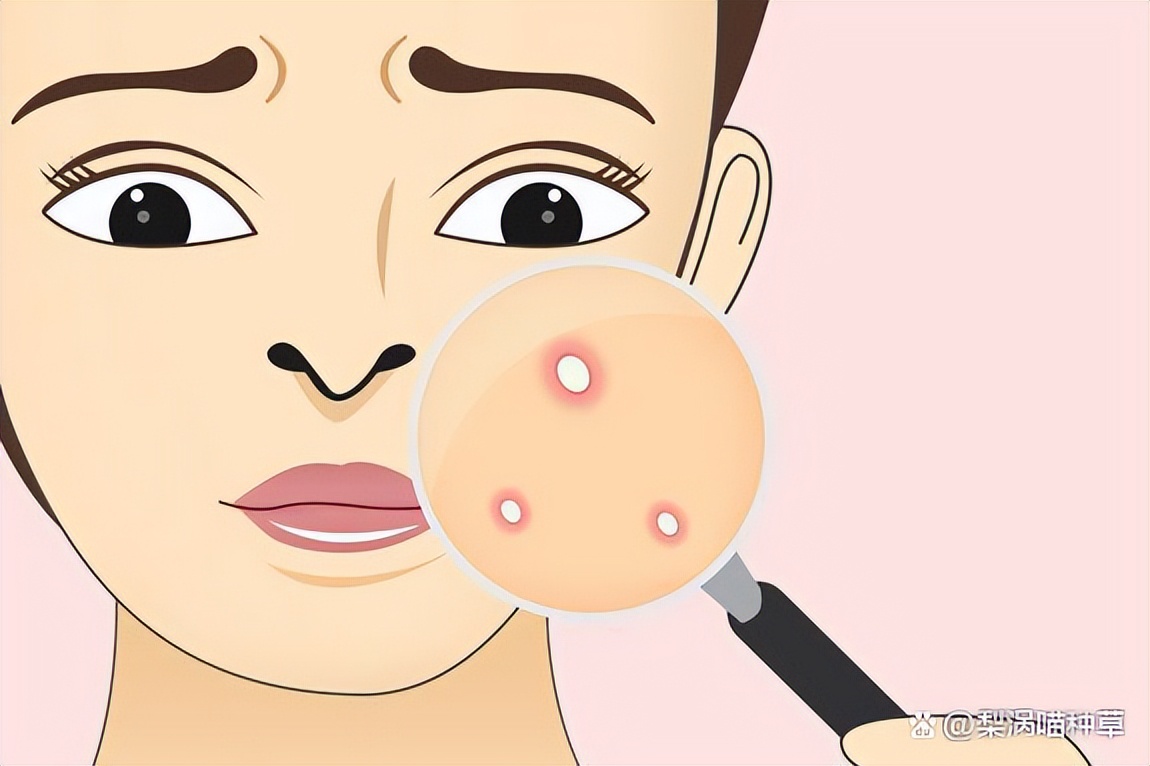油皮护肤看起来油,油皮痘痘肌看过来