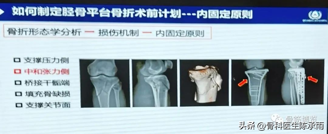 国家卫健委主办的骨创伤专项能力培训项目----下肢损伤学习班