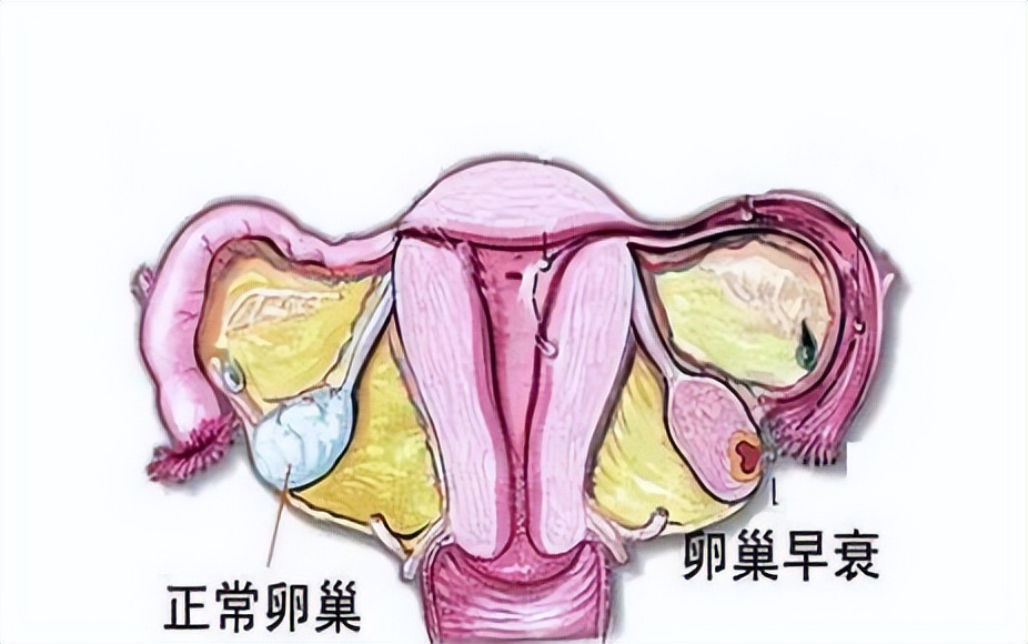 大姨妈为何总会提前,大姨妈来晚了可能是以下四种原因