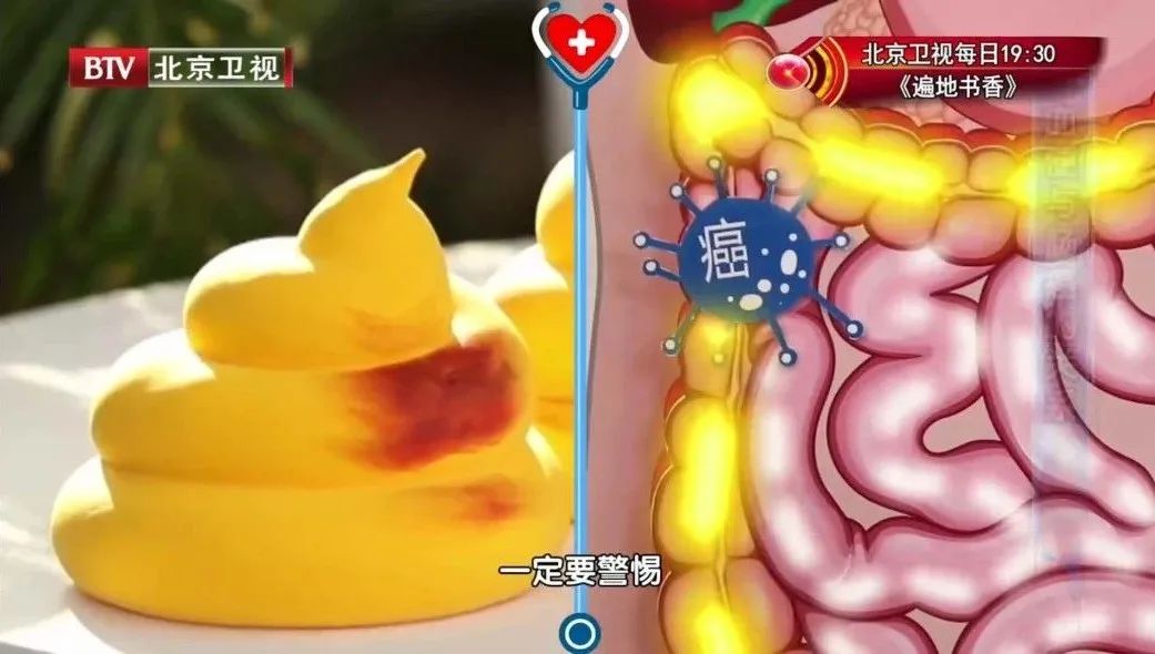 湿气大便粘马桶,大便不成形粘马桶是肠炎还是湿气