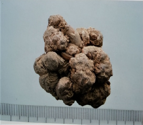 三七和金不换是一样的吗,金不换和三七是同一种中药吗