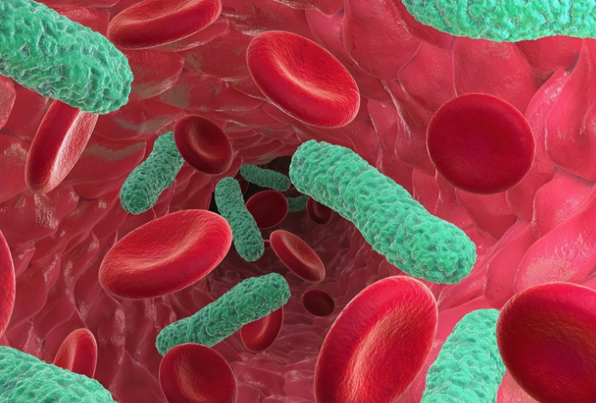 菌血症怎么治才能除根,菌血症最新治疗方法