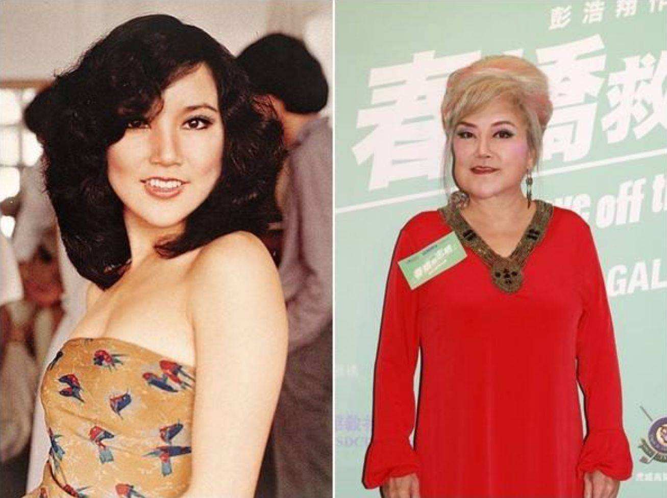 最失败硅胶脸的女星,硅胶脸女明星排行