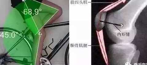 冬天骑车怎么保护膝盖,骑车前怎么保护膝盖