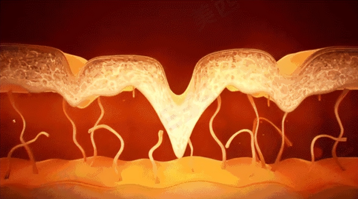 有什么像光子嫩肤一样的医美项目,医美小白看过来光子嫩肤可以做吗