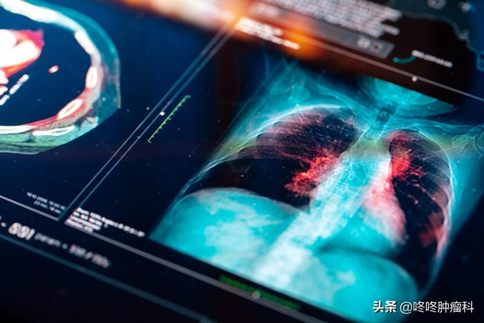 pd-1什么时候开始用于治疗,pd-1用一次药效时间