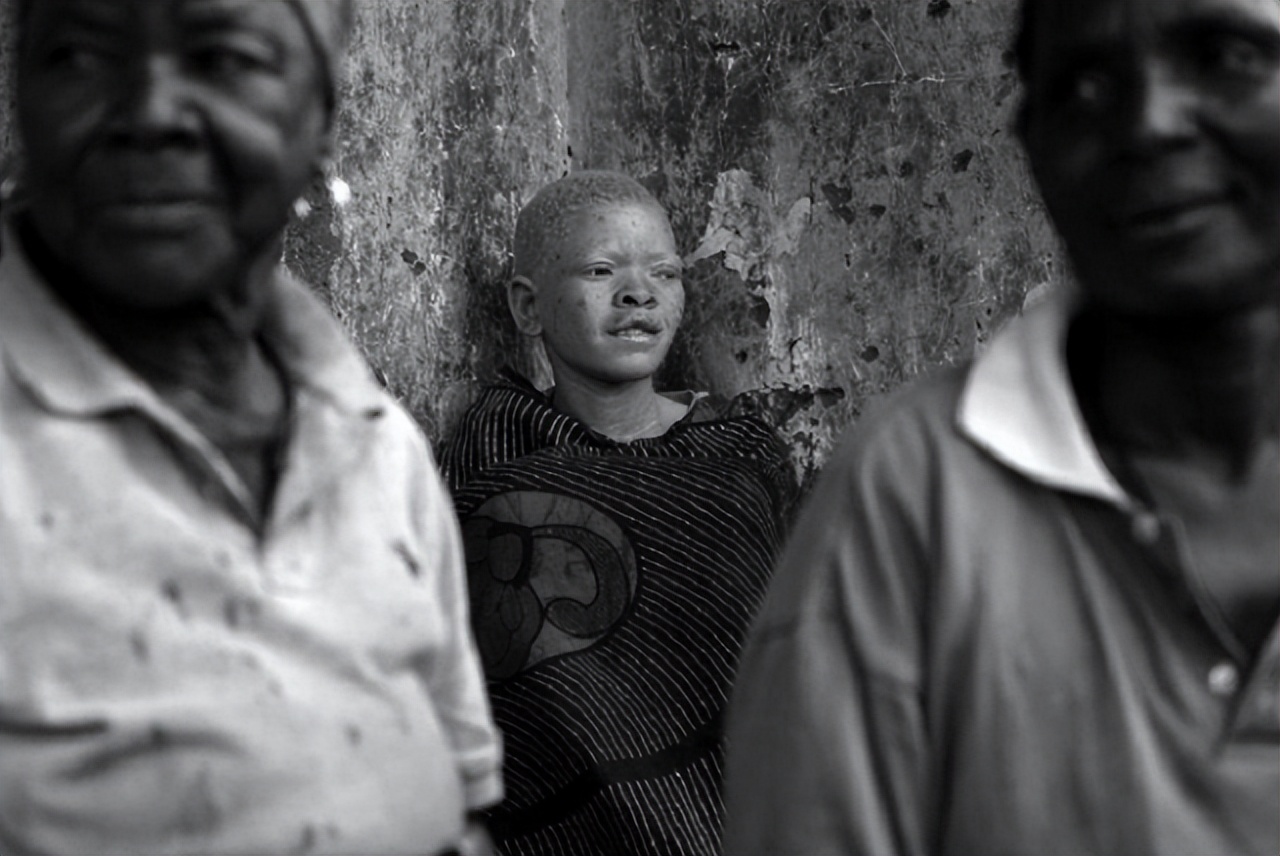 非洲出现一类“异类”，他们堪比白种人，有人出重金买他们的血液