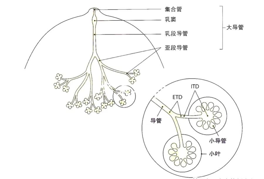 乳腺导管乳头状瘤可怕吗,导管内乳头状瘤多久会变癌