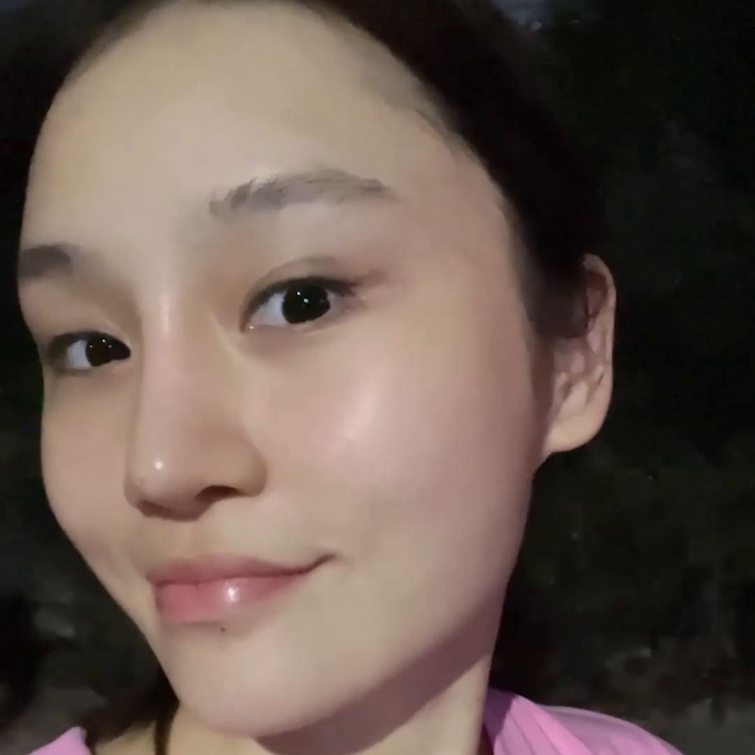 水光针真的是最划算最值得投资的抗老项目！！想打水光又怕...