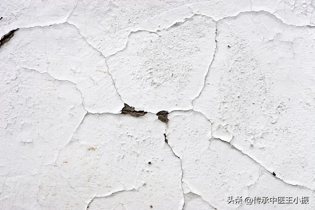 齿痕舌和裂纹舌中医辨证,舌胖大有齿痕中医辨证