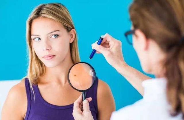 黑斑上长黑痣是不是有癌细胞,身上长黑痣越来越多会是癌细胞吗