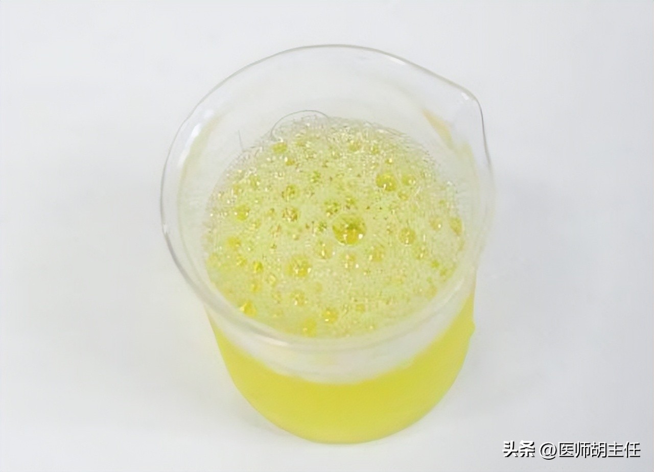 除了泡沫尿，这3个症状也是肾脏受损的征兆！不要走到透析这一步