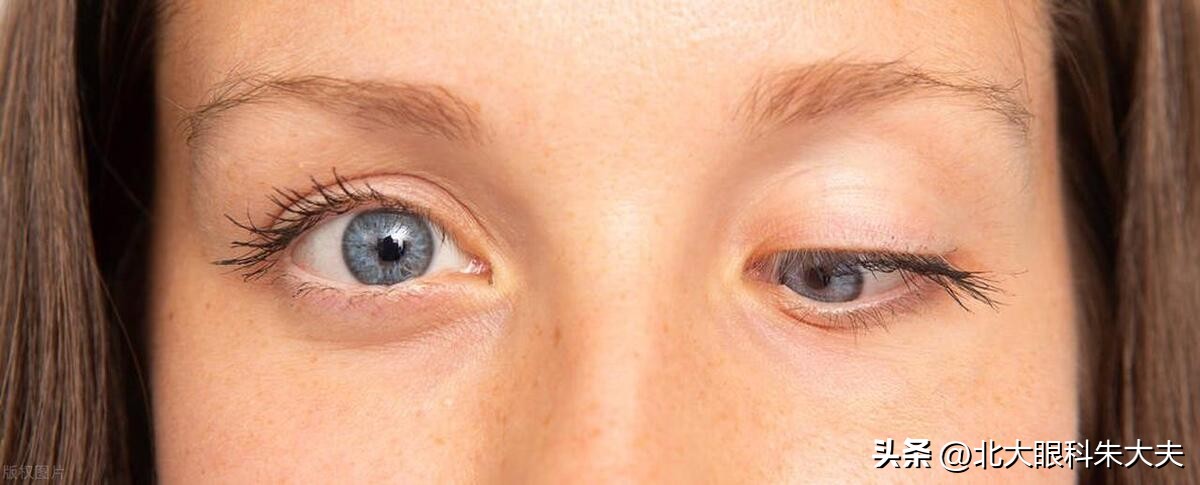 小孩眼皮下垂什么原因,眼皮下垂什么原因引起的