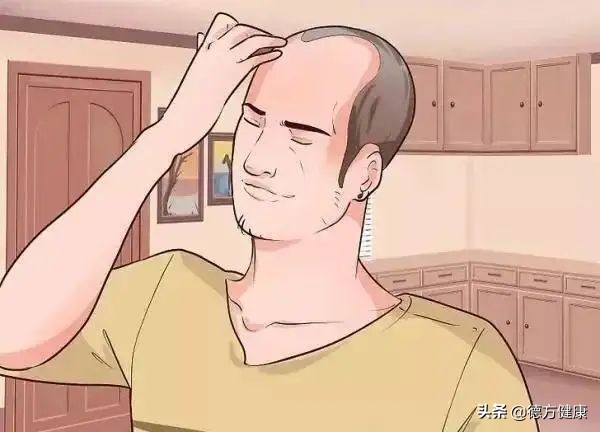 脱发真的无药可救了吗,严重脱发这几件事千万别做