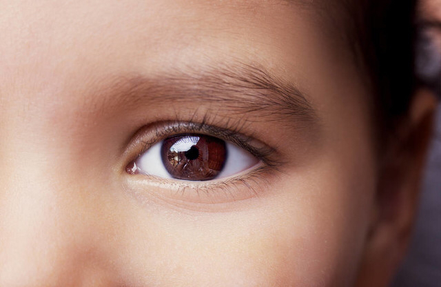 激光近视手术官司,近视眼激光手术算病假吗