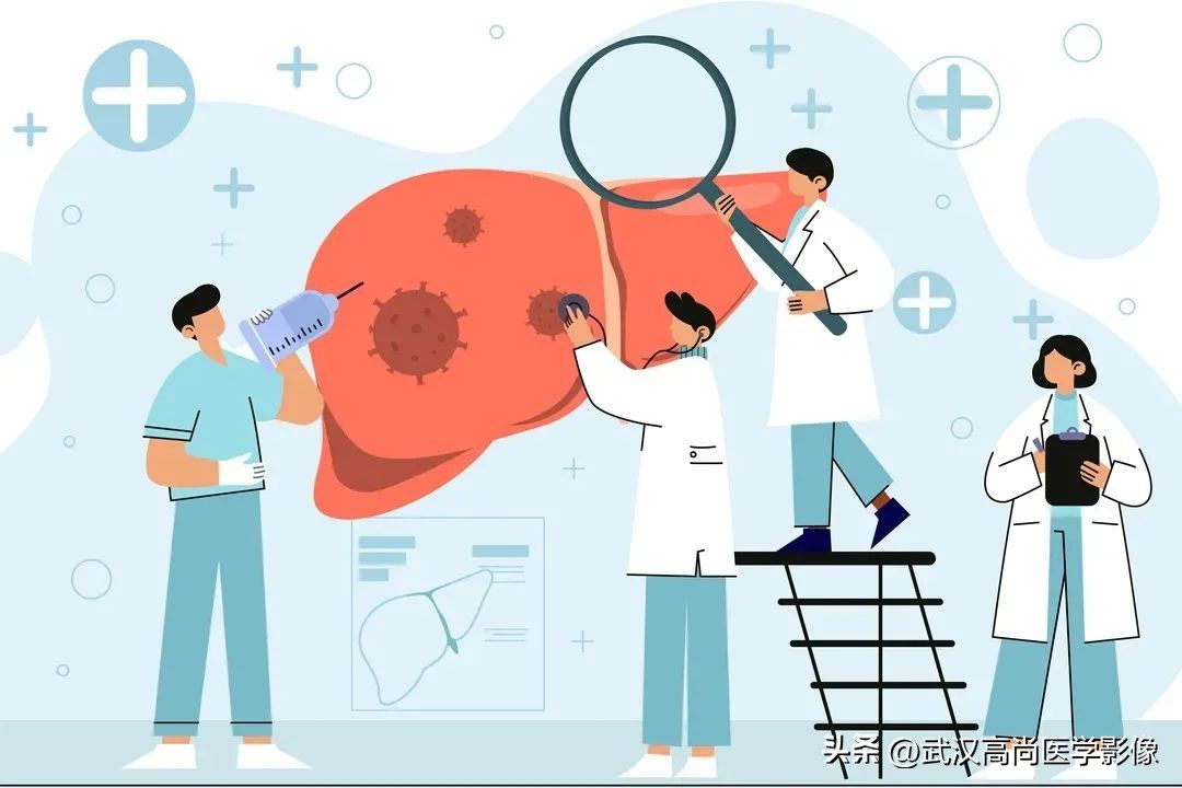 囊肿哪些检查后确认癌症,囊肿检测肿瘤指标很高