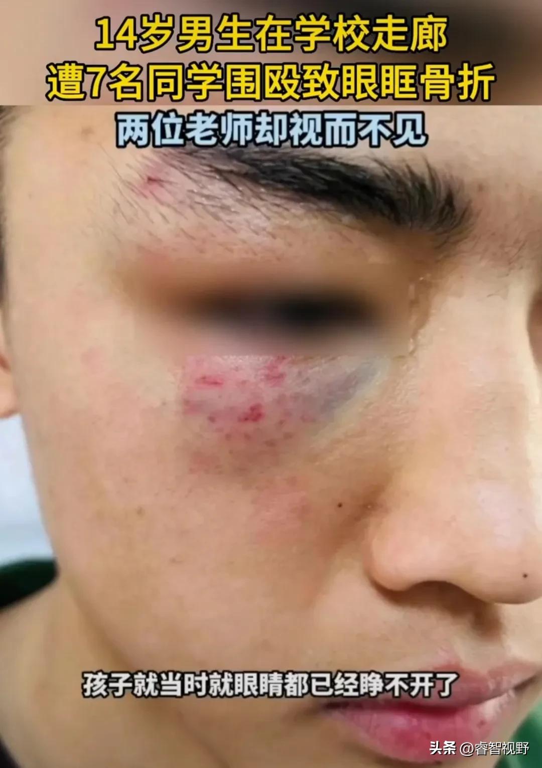 济宁14岁男生在学校被围殴，两位老师视而不见。