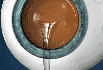 高考后迎摘镜热！在聊城这家眼科医院做ICL晶体植入术可享大福利