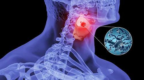 慢性支气管炎一直不好是什么原因,慢性支气管炎总是反复怎么办