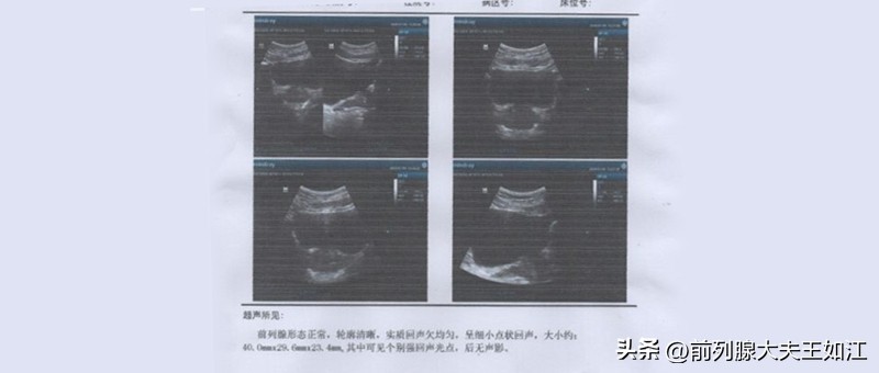 腹痛睾丸痛的前列腺炎怎么治,慢性前列腺炎小腹坠胀冶了一年