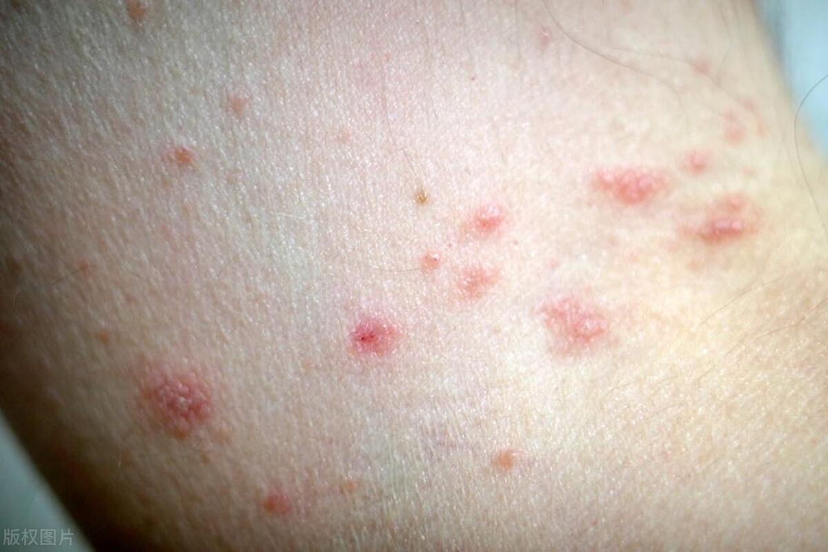 醉酒后误闯楼下房间,喝酒醉误闯别人房间