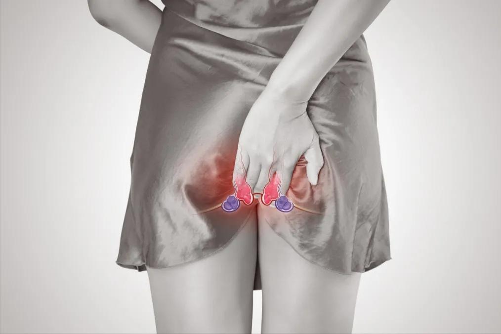 肛门湿疹反复发作怎么治疗,肛门湿疹反复发作该怎么治疗