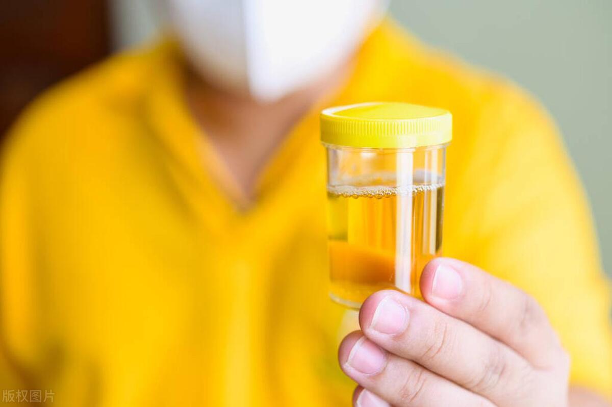 一位单身女青年的疑问：同房时，男人尿尿和射精会同时发生吗？