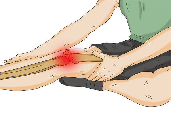 “封闭针”是什么？适合哪些患者？能经常打吗？看完就知道了