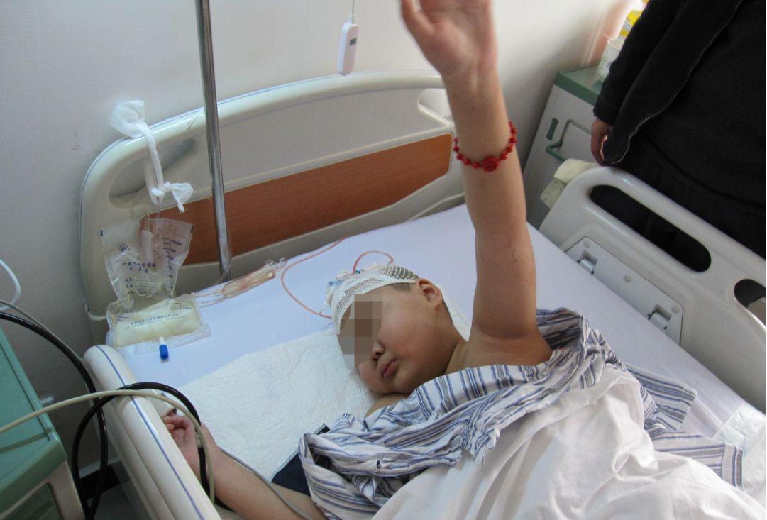 儿童结核脑膜炎脑积水,结核性脑膜炎脑积水如何引起