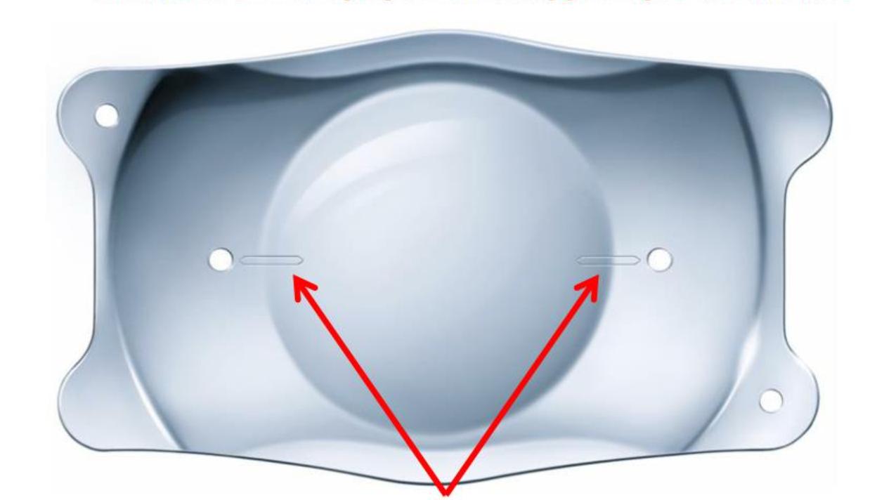 散光适合用miniled屏吗,散光能用icl晶体治疗吗