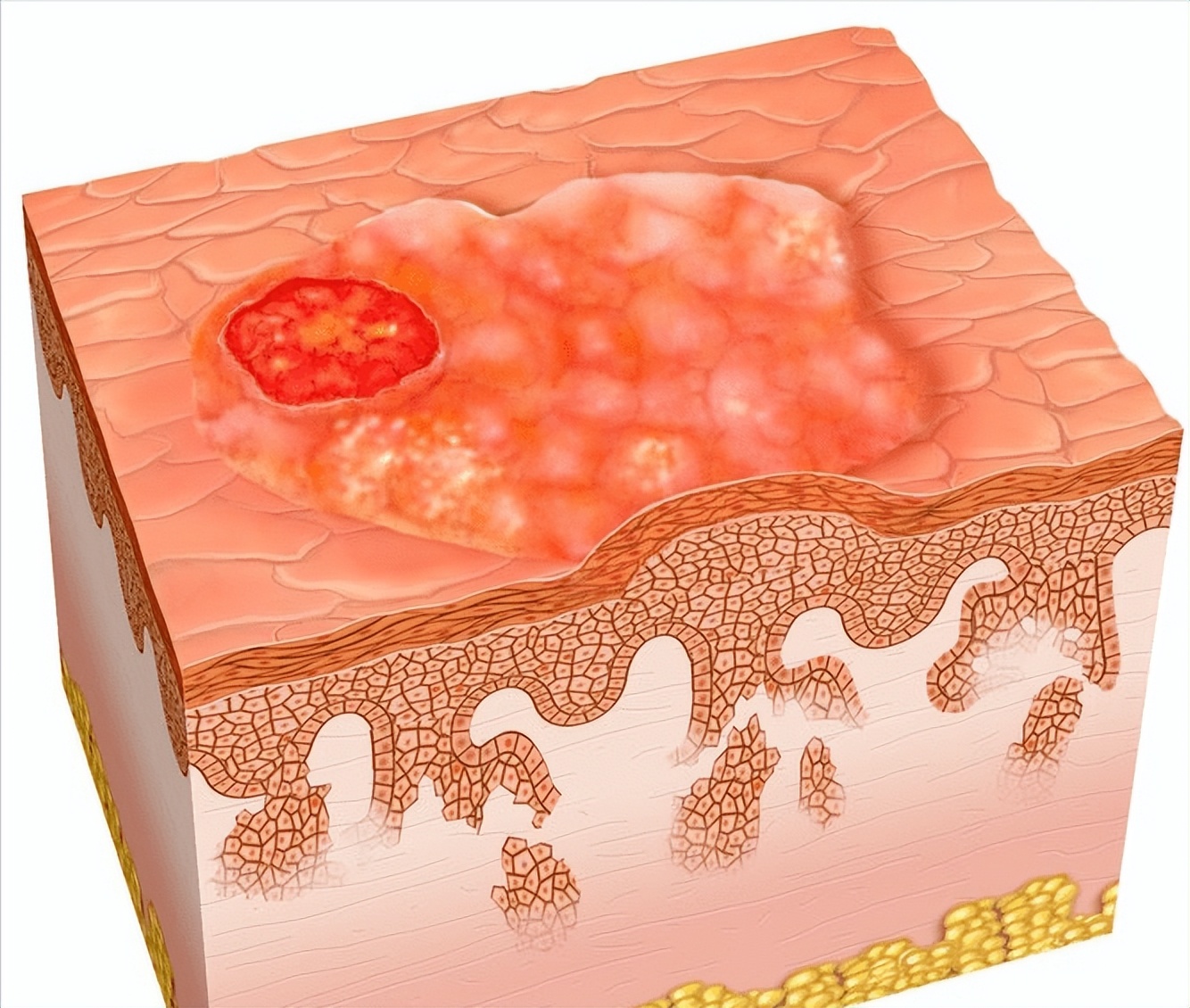不看不知道，原来你患的是萎缩型外阴白斑