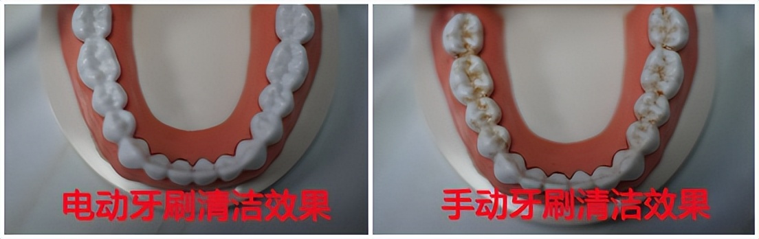 好用的儿童电动牙刷真实测评,1-6岁儿童电动牙刷测评排行榜