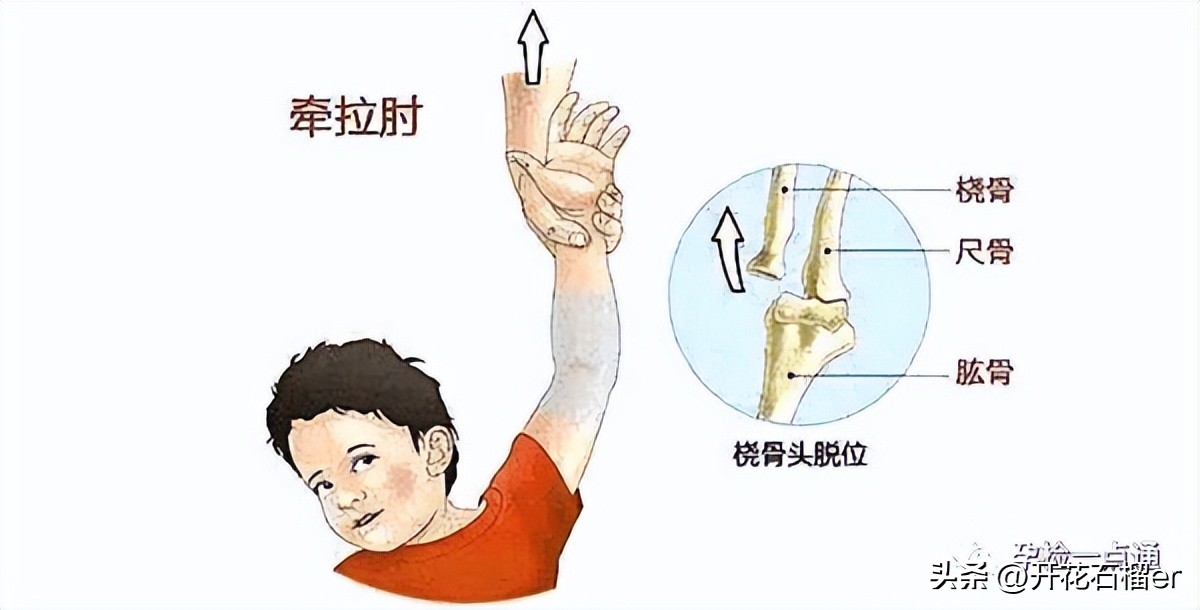 小月龄宝宝习惯把屎把尿如何纠正,8个月宝宝把屎把尿到底好不好