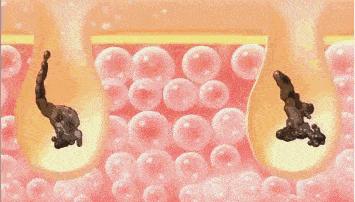 科颜氏美白淡斑精华去痘印,科颜氏美白淡斑精华液去痘印