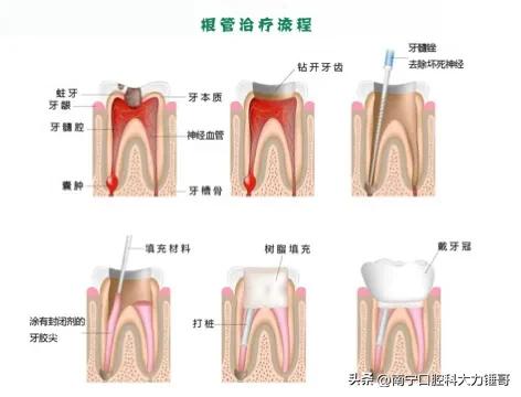 一颗牙得花多少钱,看一次牙