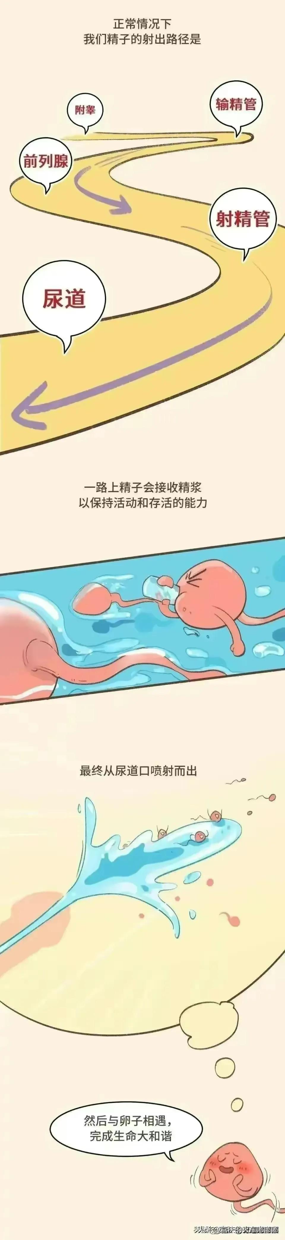 射之前戴安全套，不*射内**到底会不会怀孕？