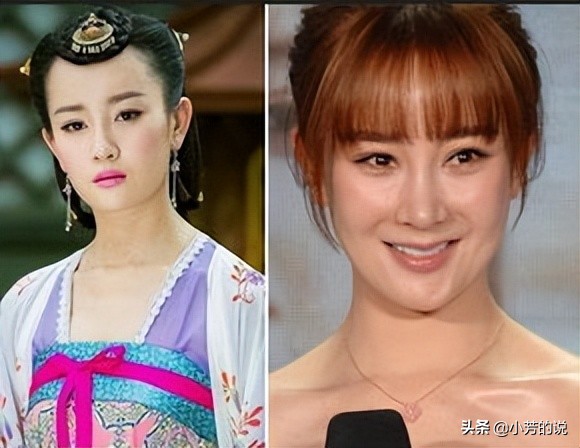 整容后出车祸假体外露,整容了被砸到脸会怎么样