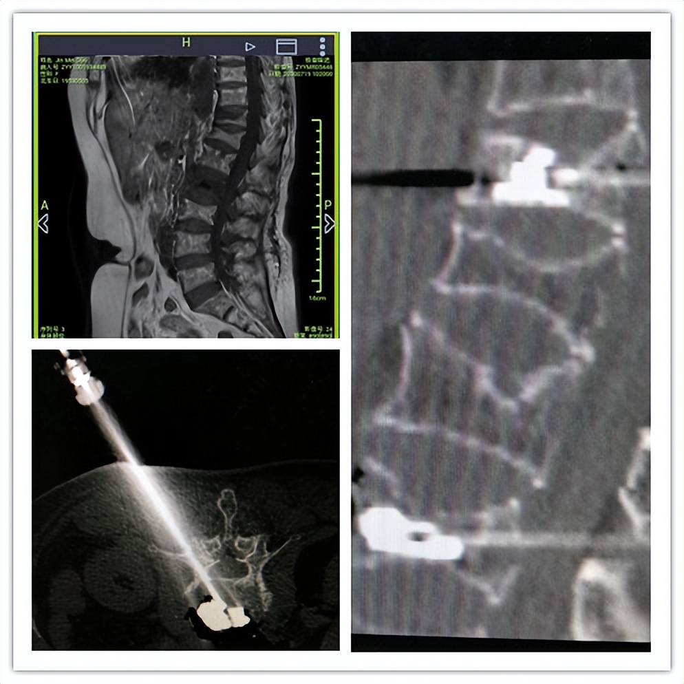 嘉善人民医院疼痛科专家,嘉善第一人民医院中医内科