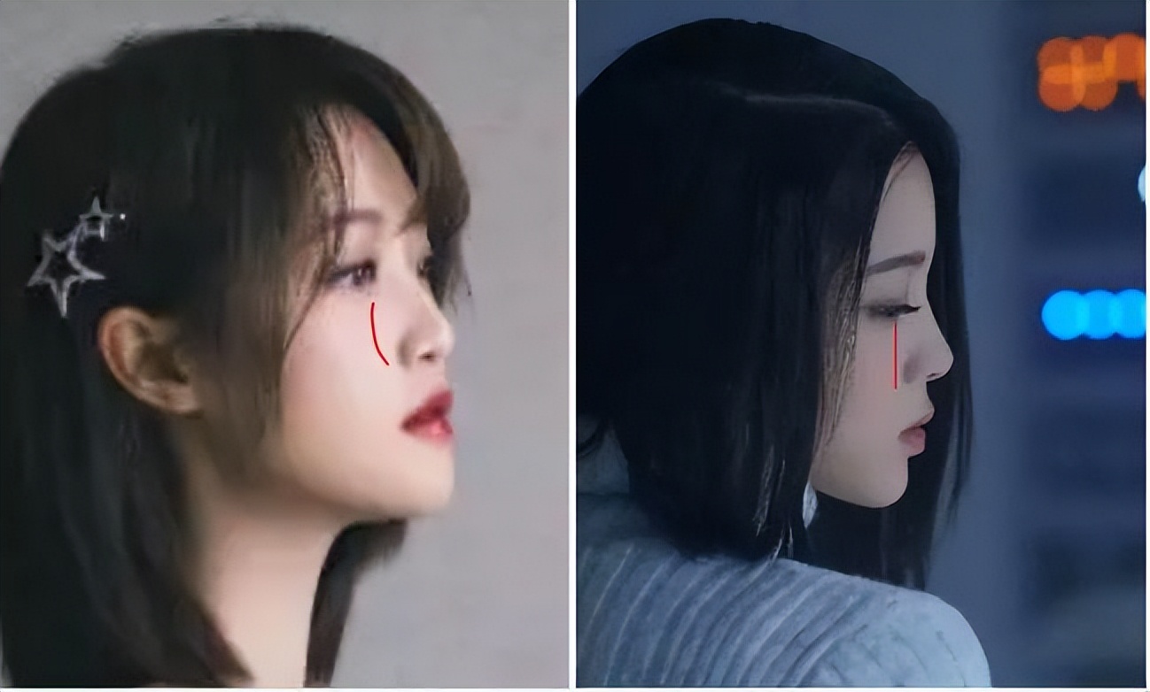 扁平脸影响美感,扁平头会对颜值有影响吗