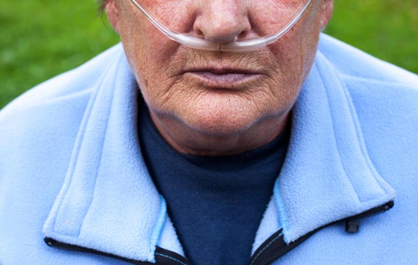 制氧机必须要药剂吗,制氧机需要耗材吗