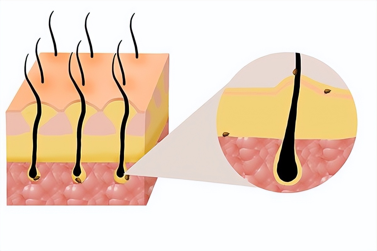 阴虱为何很少见了,阴虱为什么不叫阳虱