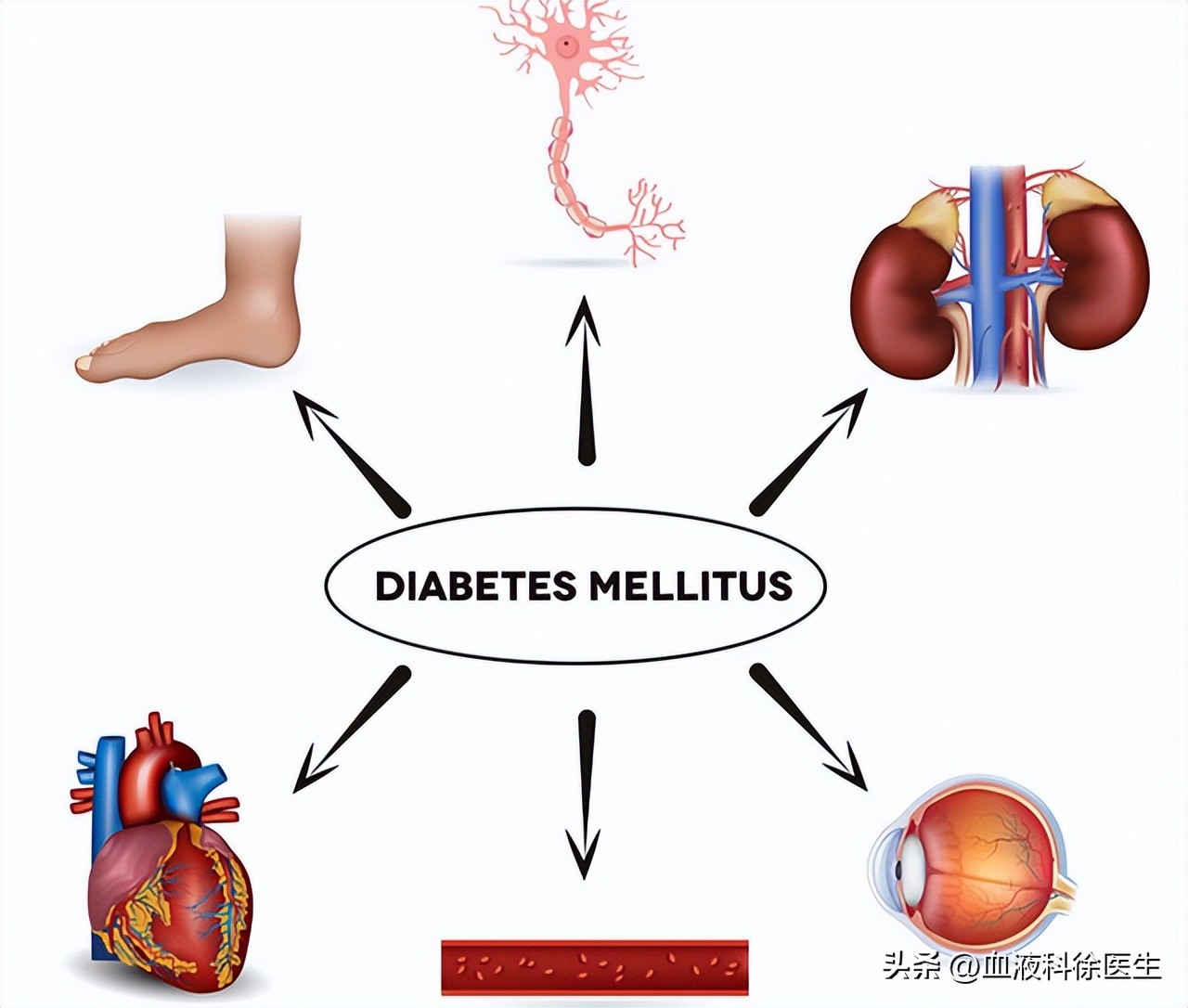 血糖高的人建议吃水果吗,血糖高的人吃水果注意什么