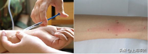 早预防早干预莫等患病才后悔,早预防早筛查