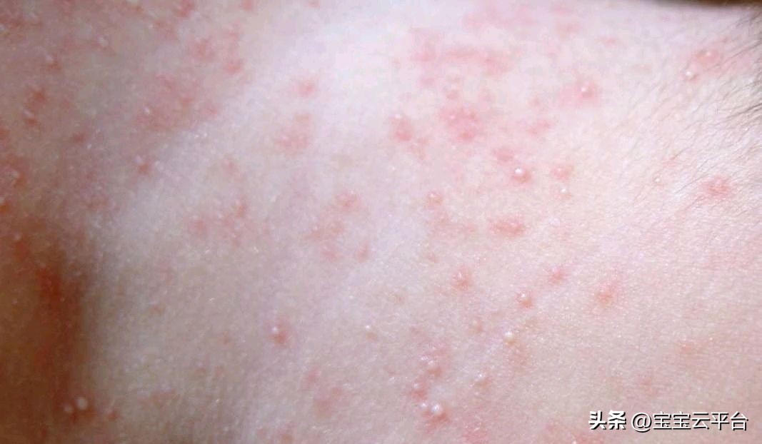 那些你必须知道的事，宝宝满月前的护理重点！新手爸妈必看！