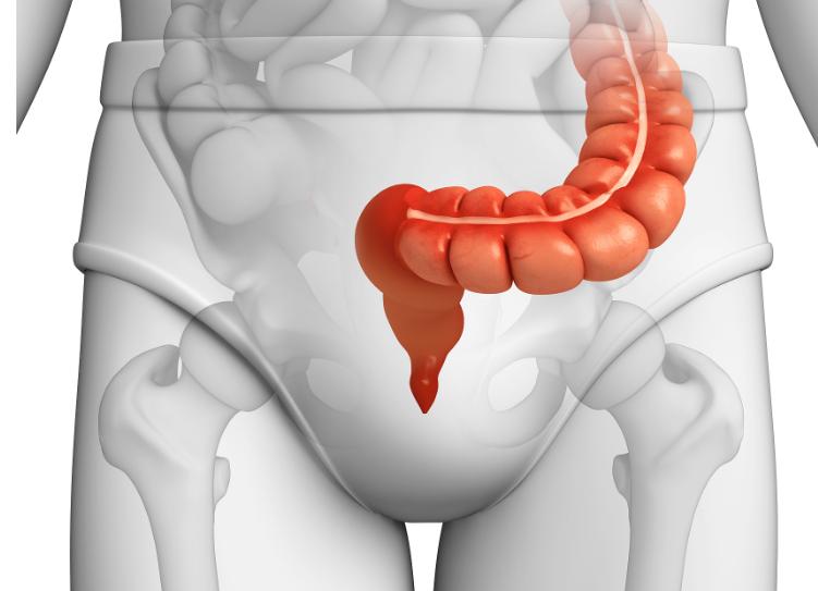 女性为什么会出现肛裂,为什么女人更容易得肛裂呢