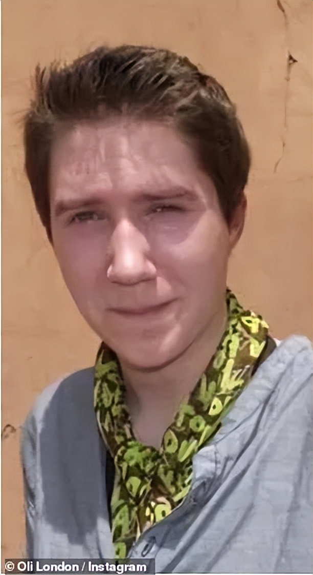 白人网红沉迷韩国流行文化，疯狂整容还做丁丁缩小术？