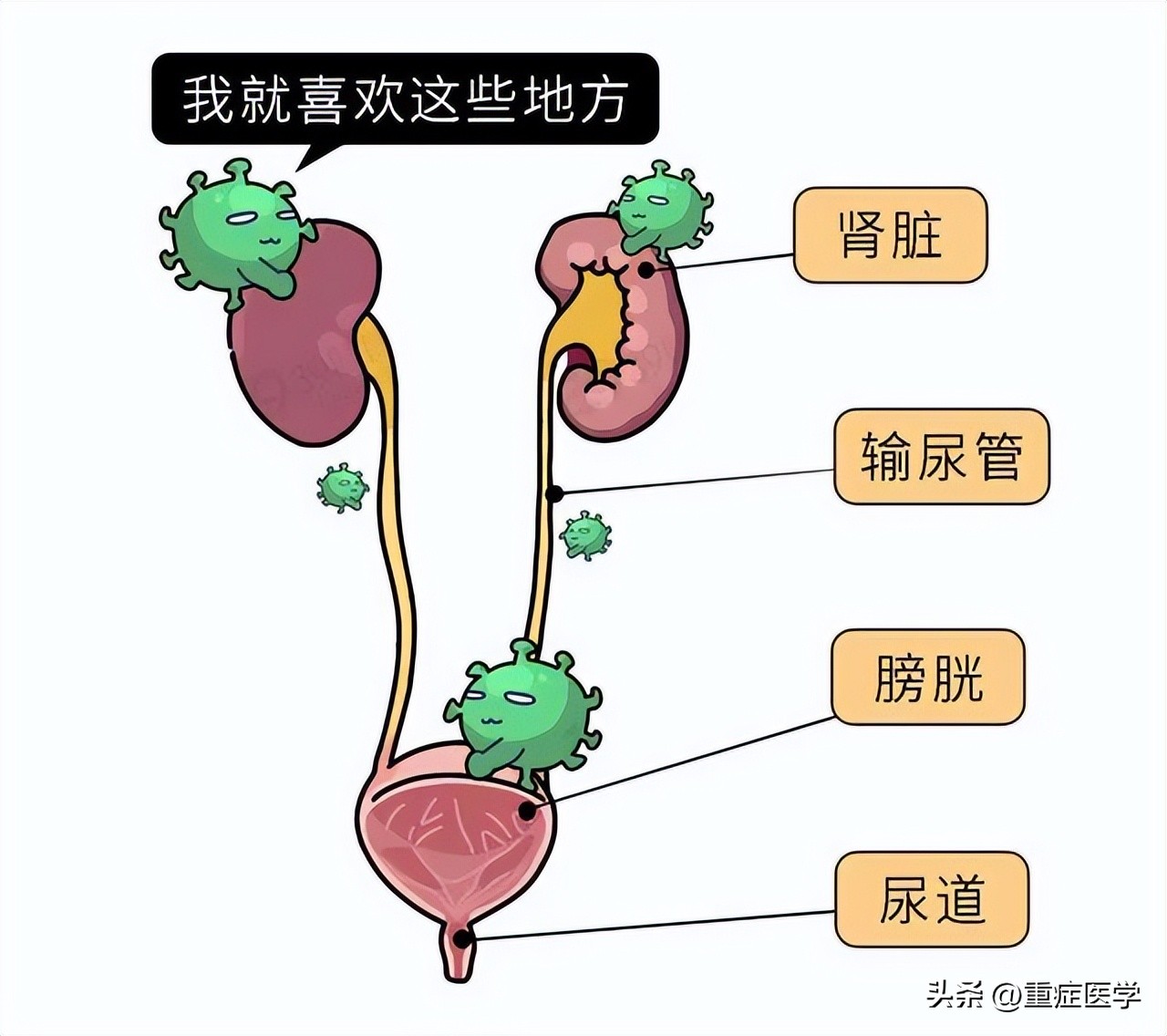 十种用于治疗尿路感染的中成药,尿路感染吃什么中成药比较好呢